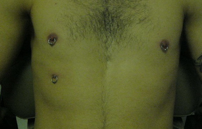 Nipple piercing